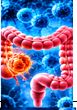 Respiratory Infections