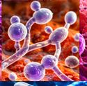 Respiratory Infections