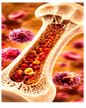 Respiratory Infections