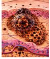 Respiratory Infections