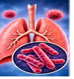 Respiratory Infections